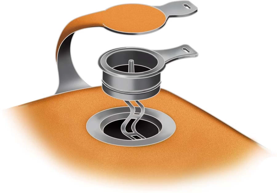 Nemo Tensor Insulated Ultralight Sleeping Mat 6 Nemo Tensor Insulated Ultralight Sleeping Mat - Image 6